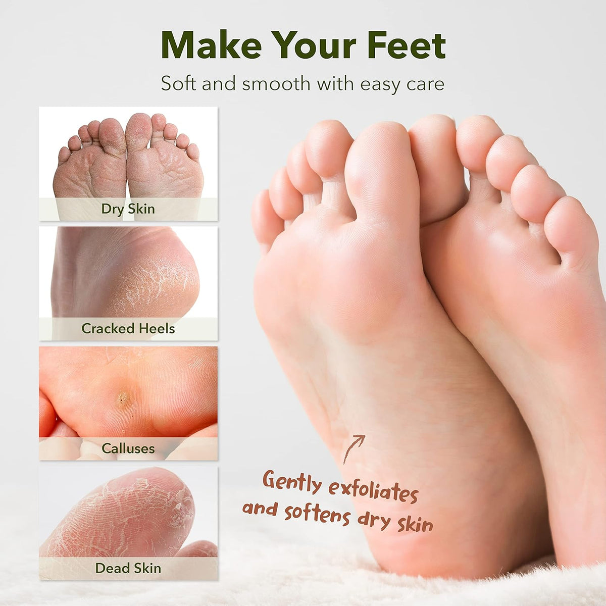 Purederm Shiny & Soft Foot Peeling Mask (6 pack) - For smooth and moist baby skin with Exfoliating peel off Calluses, Dry Skin, Cracked Heels - Men and Women
